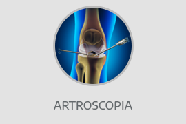 Artroscopias