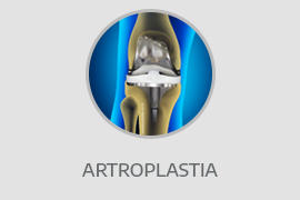 Artroplastias - próteses