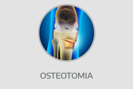 Osteotomia