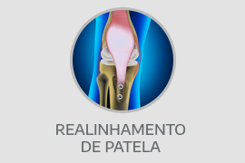 Realinhamento de patela