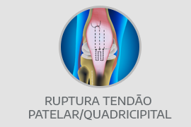Ruptura tendão patelar/quadricipital